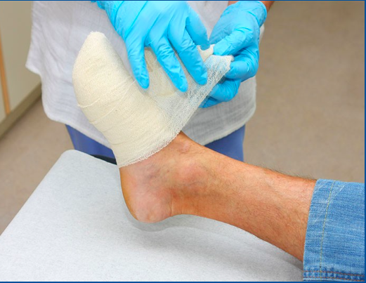 Wound Care Wound Care